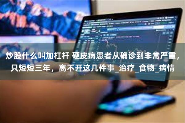 炒股什么叫加杠杆 硬皮病患者从确诊到非常严重，只短短三年，离不开这几件事_治疗_食物_病情