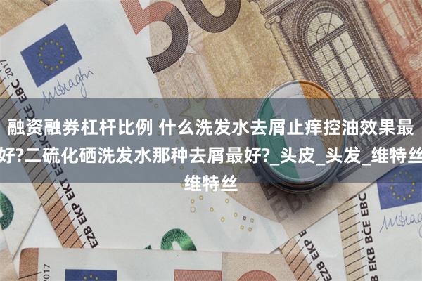融资融券杠杆比例 什么洗发水去屑止痒控油效果最好?二硫化硒洗发水那种去屑最好?_头皮_头发_维特丝